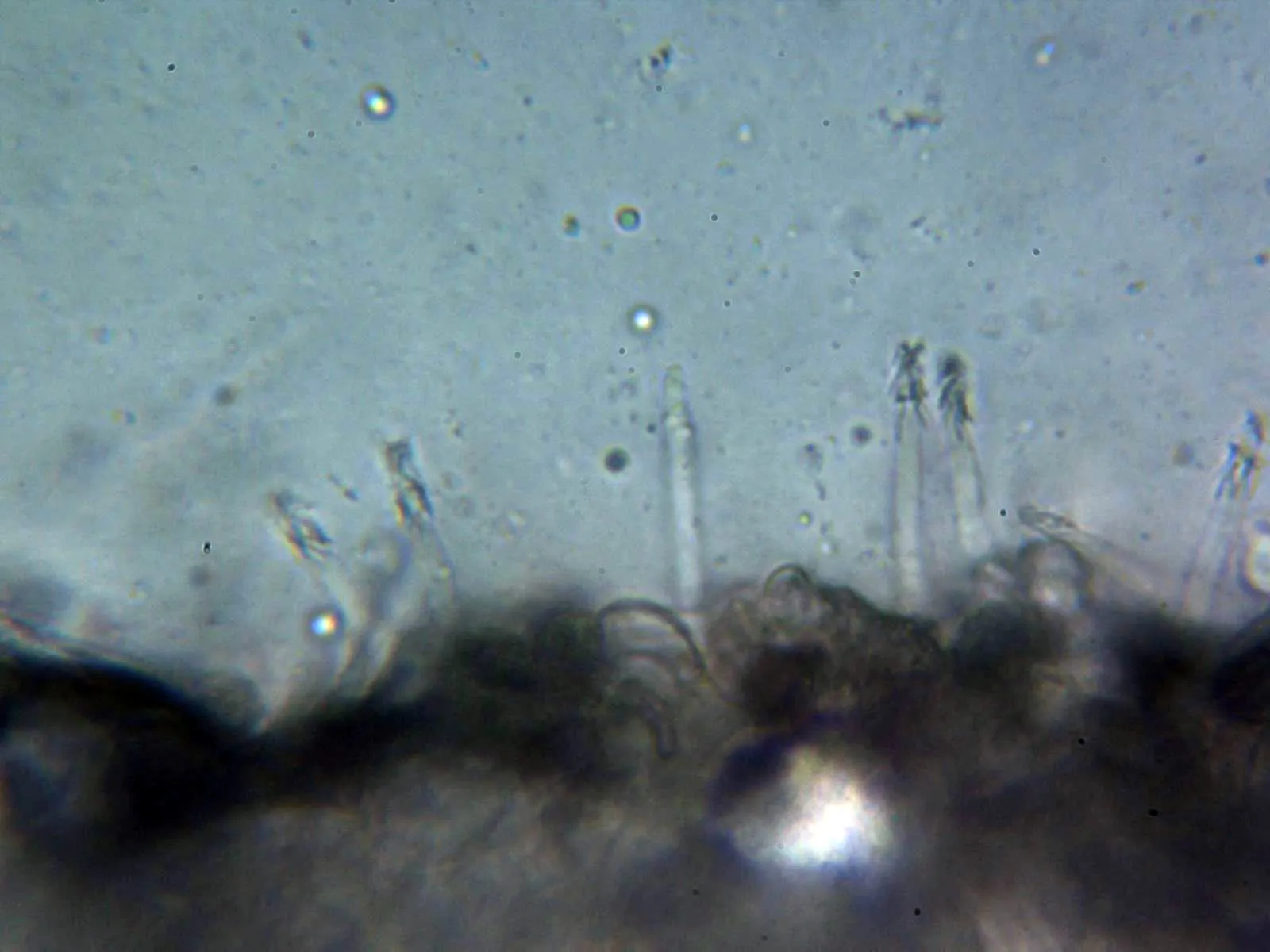 Microscopía de Melanoleuca grammopodia - 10 - Queilocistidios 2